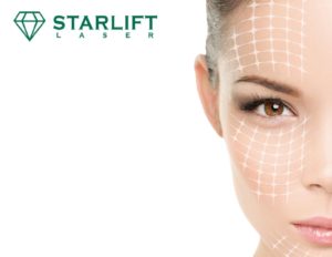Agence Webmarketing Paris - Starlift Lasers - Fabricant Esthétique